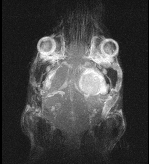 Brain-tumor-in-vivo2-1