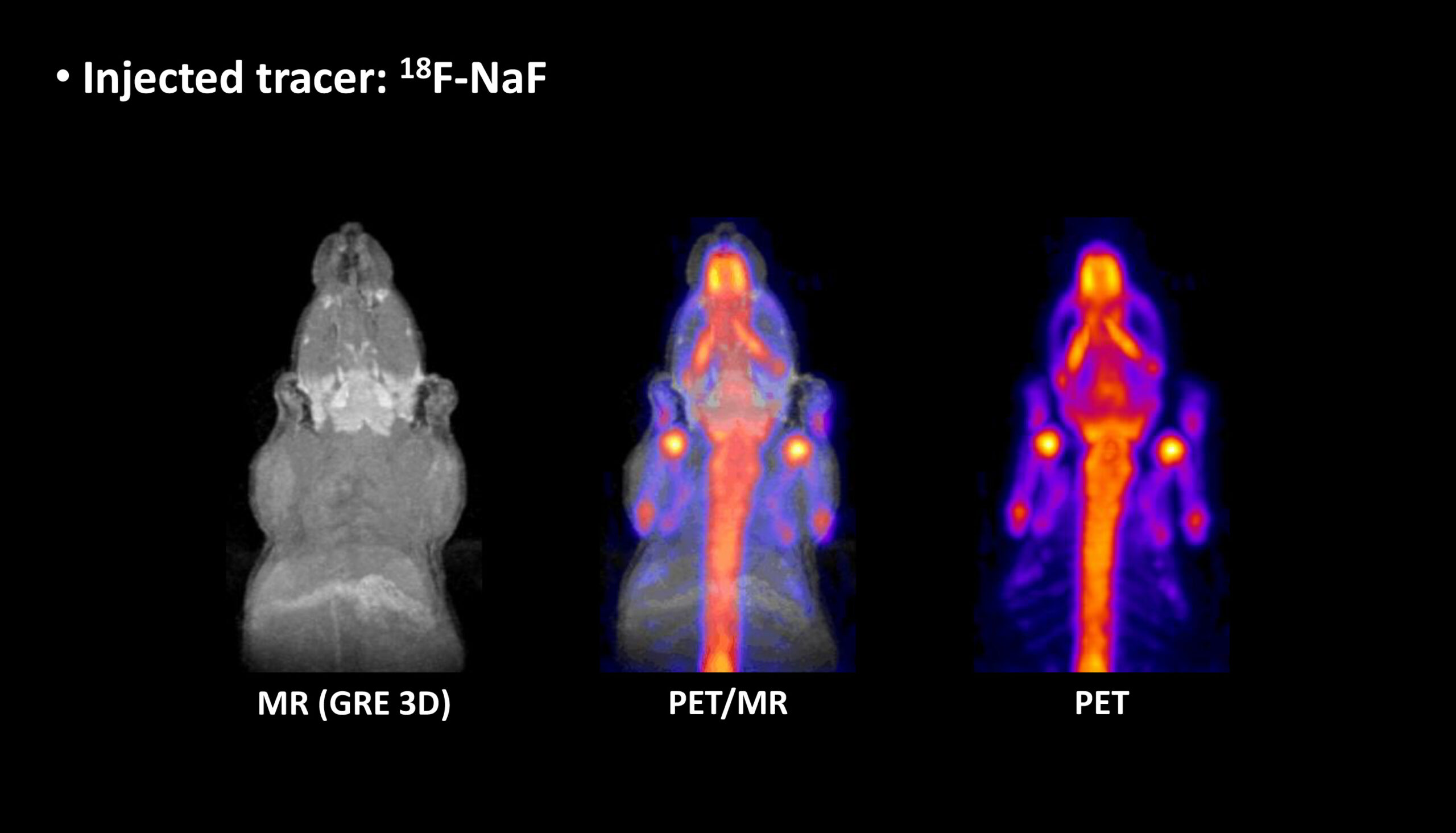 PET-MRI-image_gallery-